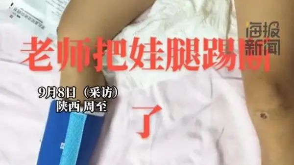 » 9、陕西周至一学生被老师踢断腿骨近日，陕西周至县终南信民学校学生家长在社交平台发布视频称，其孩子在学校遭老师体罚，孩子的腿骨被踢断引发社会关注