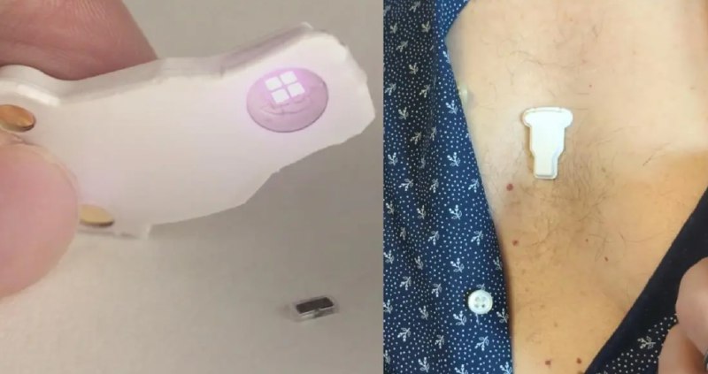 » 10. 中美联合研发3.5毫米心脏起搏器 可自发溶化降解美国西北大学团队领衔，联合新加坡国立大学、中国华中科技大学等多所大学的研究者，合作开发了世界上最小的心脏起搏器，体积比一粒米还小！北京时间4月2日，《自然》期刊发表了一项由美国西北大学教授、生物电子研究所主任约翰·罗杰斯团队领导的研究，介绍了这款堪称目前世界上最小的心脏起搏器