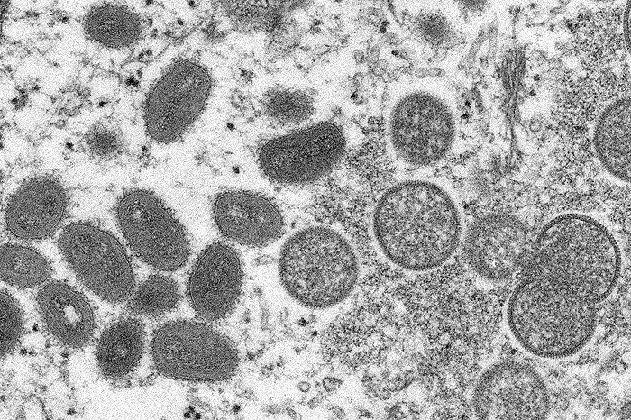 7. 欧美多国爆发猴痘疫情，或存在多条不明传播链19日，意大利和瑞典通报各发现一例猴痘病毒